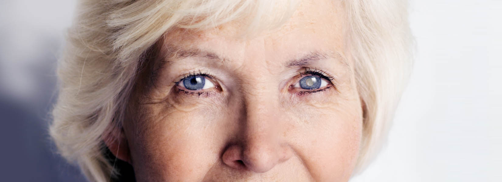 Cataract Surgery in Grabill